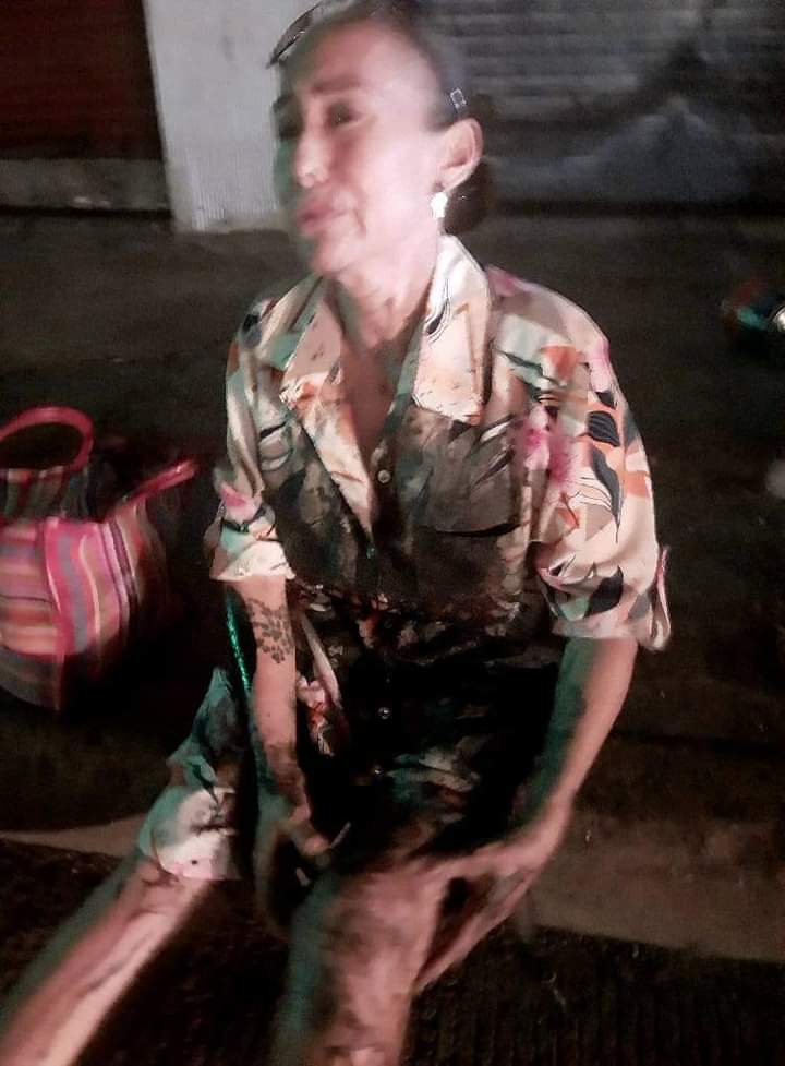 FUERTE ACCIDENTE DEL DUEÑO DEL GIMNASIO ALEXO’S Y SU HERMANA AL CHOCAR CON MONTÍCULO DE TIERRA DEJADA A MEDIA CALLE POR CAPAMA