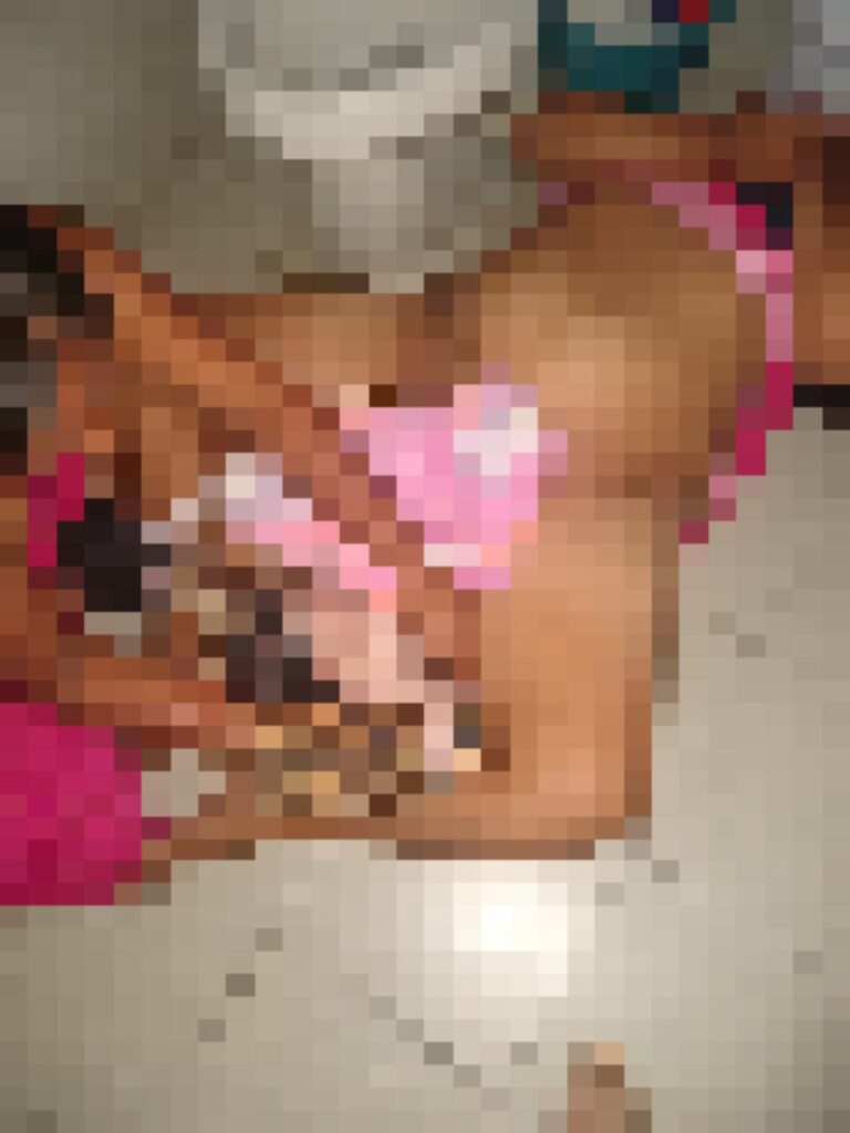 Mujer da a luz en los baños del CAAPS