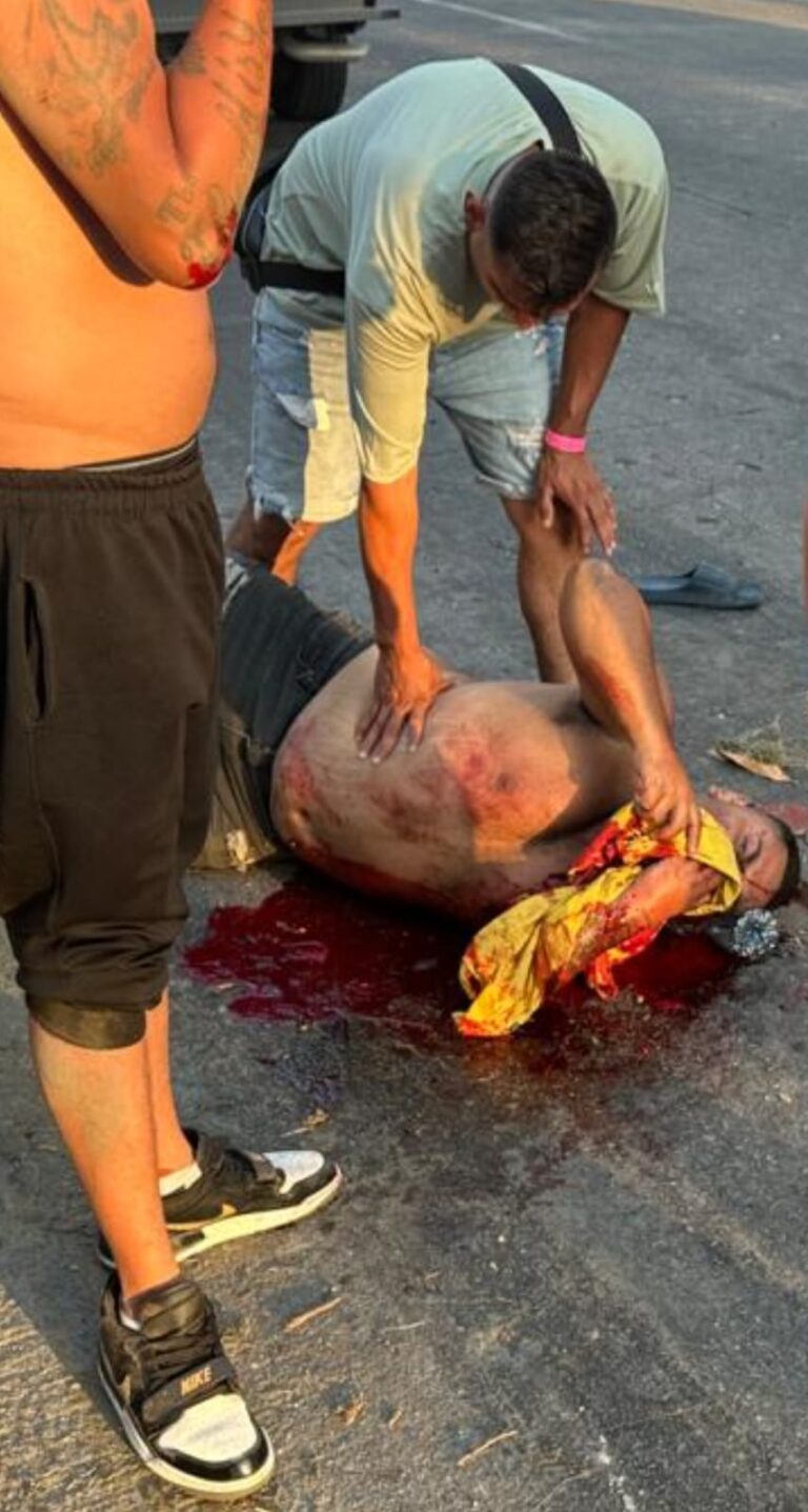 Derrapa motociclista en la Costera