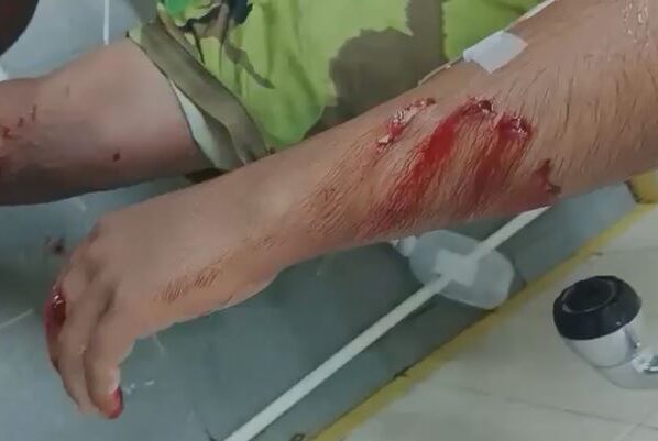 Cocodrilo ataca a un turista en la Barra de Potosí, Petatlán