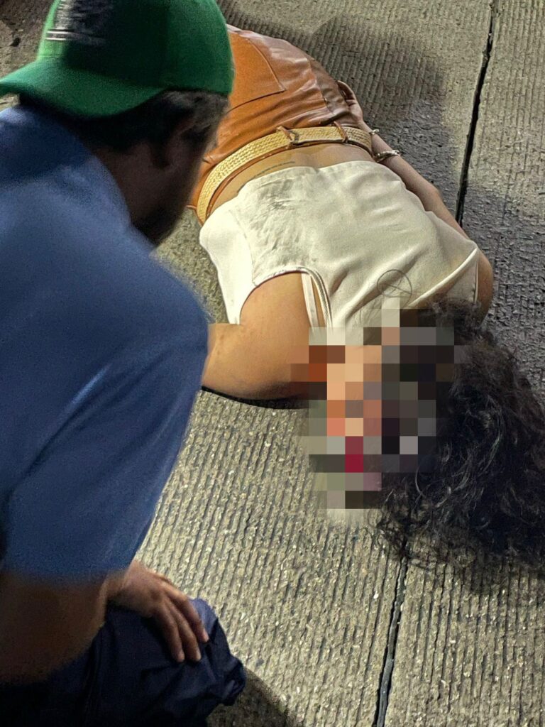 Derrapa motociclista, resulta con heridas de gravedad