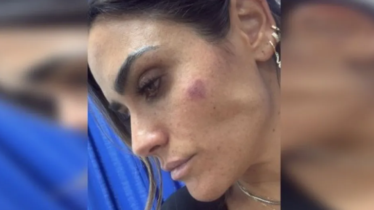 Denuncia Alessandra Rojo de la Vega agresiones hacia ella y su equipo durante operativo